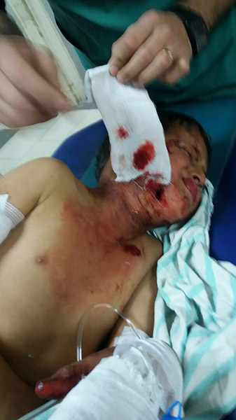 afrin hopital